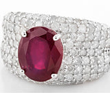 Ruby and Diamond Ring