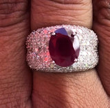 Ruby and Diamond Ring